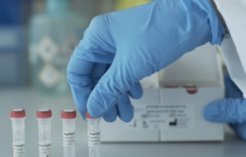 Od ponedeljka BITNE IZMENE u testiranju na koronavirus: Klinički centar Srbije izdao saopštenje