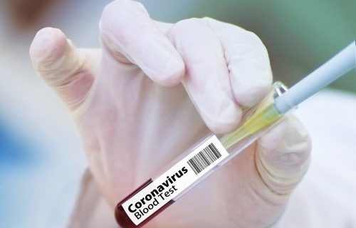 koronavirus-vakcina