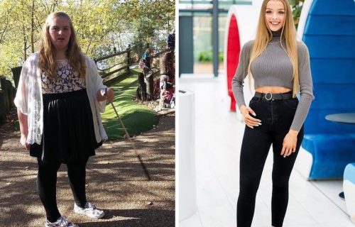 Studentkinju (18) zlostavljali zbog DEBLJINE, a onda se zainatila i oslabila 50 KILOGRAMA: Evo šta je prestala, a šta počela da jede (FOTO)