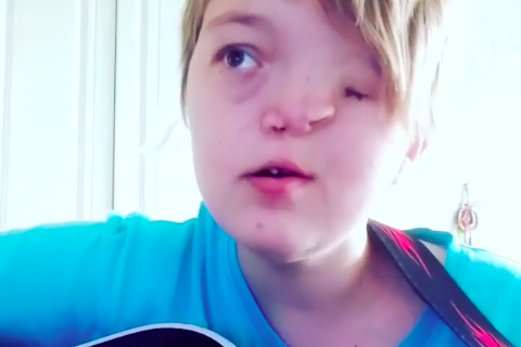 Jaroslava je rođena bez pola lica, otac ju je napustio čim ju je video: Sada ima samo jednu želju (VIDEO)