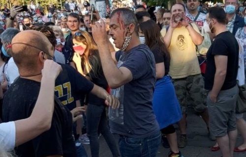 Nasilni demonstranti napali Sergeja Trifunovića i razbili mu glavu