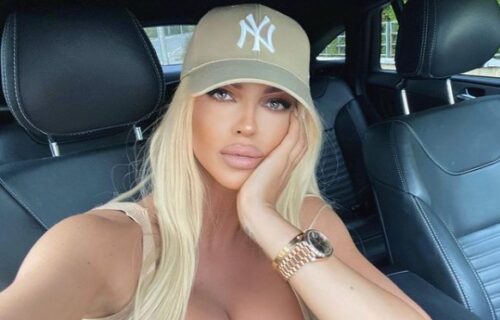 Jelena Karleuša ima potpuno nove USNE i to RUSKE! Pokazala kako izgleda odmah posle intervencije (FOTO)