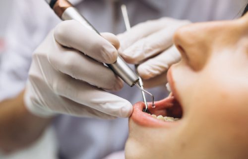 Nastavlja se akcija besplatnih pregleda: Danas možete posetiti stomatologa, bez knjižice i zakazivanja