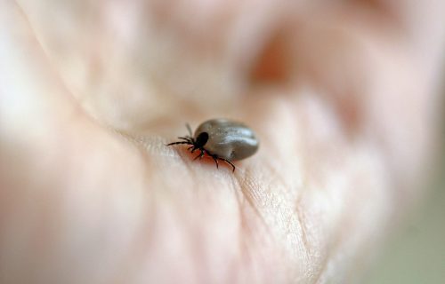 Šta MORATE da uradite ako vas ujede krpelj? Doktorka Krstić detaljno objasnila proceduru