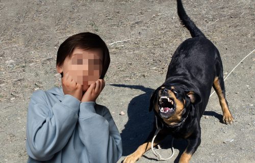 Rotvajler IZUJEDAO dečaka (11) u Prokuplju: Dete hitno primljeno u bolnicu