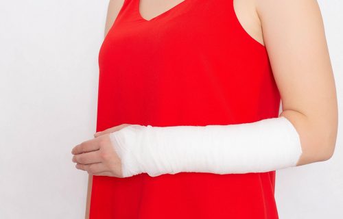 "Banjicom" odzvanjale BOLNE reči: Taman što je skinula gips udario je auto, a onda ponovo usledio PAKAO