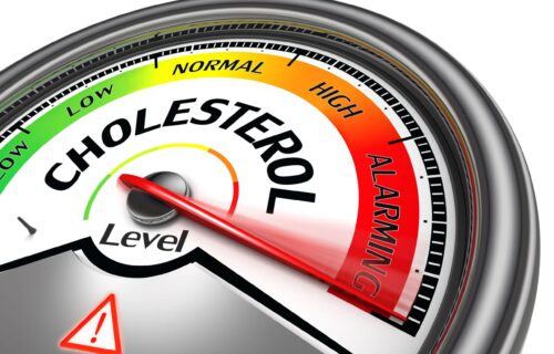 POST i holesterol: 10 namirnica koje treba da jedete narednih mesec dana ako želite da OČISTITE telo