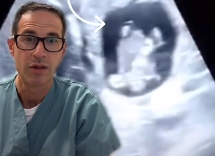 Mislio da je video sve: Doktor ostao u čudu kada je na ultrazvuku video šta RASTE U JETRI žene (VIDEO)