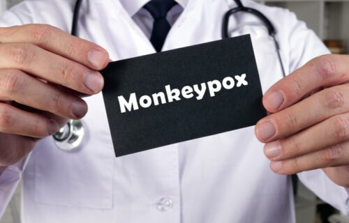 Batut šalje UPUTSTVO lekarima: Za majmunske boginje ovo je POSEBNO karakteristično