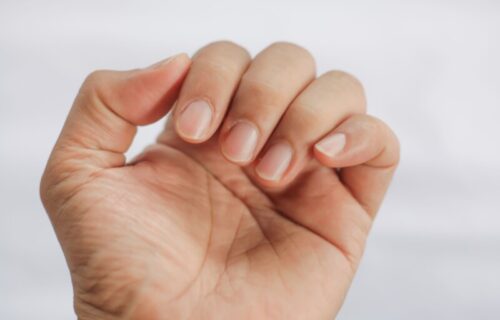Ogledalo vašeg zdravlja: Ako primetite OVE promene na noktima, odmah tražite pomoć lekara