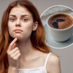 Kako konzumacija kafe utiče na kožu i na koje stvari morate da obratite pažnju?