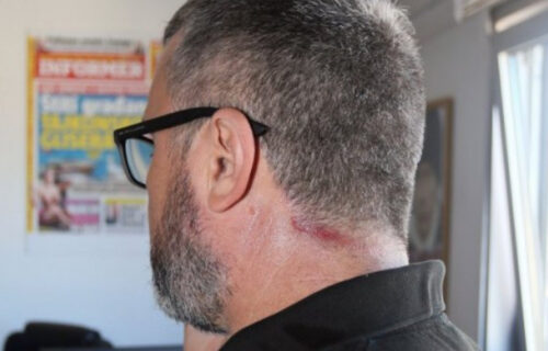 Napadnut glavni urednik Informera Dragan J. Vučićević (FOTO)