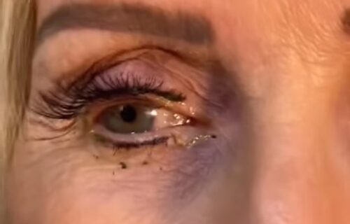 Doktorki Katarini se žena žalila da je boli OKO: Kada je videla šta VIRI iznutra, zaprepastila se (VIDEO)