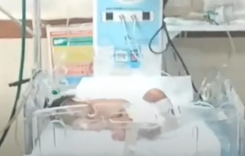 Beba je izgledala normalno, dok nisu videli šta je ISPOD STRUKA: Slike sa porođaja obišle svet (VIDEO)
