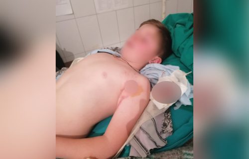 "Vraćali smo se putem, odjednom je neko počeo da PUCA": Stefan (11) opisao NAPAD Albanca u Štrpcu