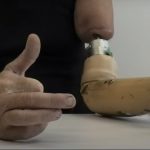 Hirurške i inženjerske inovacije omogućuju dosad neviđenu kontrolu nad svakim prstom bioničke šake