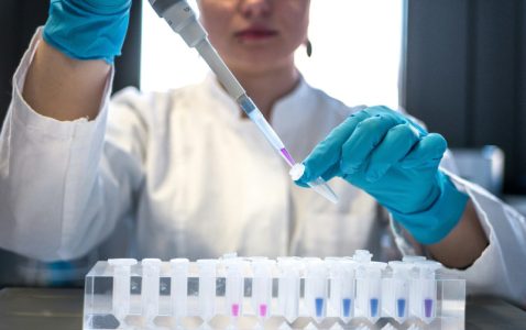 Užas na univerzitetu u Španiji: Pukla boca sa kiselinom u laboratoriji, tri osobe raznete