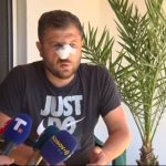 Napadnut Srbin u Donjoj Brnjici, nanete mu teške telesne povrede