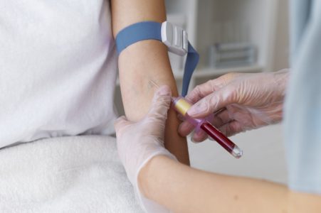 Institut apeluje na građane: Hitno potrebni dobrovoljni davaoci krvi, rezerve veoma niske