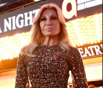 Donatela više ne liči na sebe: Mnogobrojne pohvale za nov, manje plastičan izgled (VIDEO)