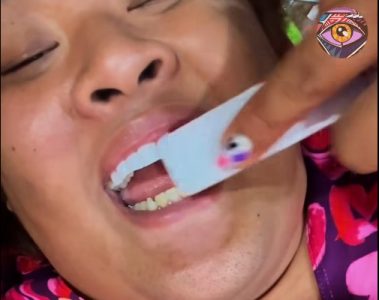 Na pomolu još jedan bizaran “beauty” trend? Lepe veštačke nokte na zube kako bi bili belji (VIDEO)