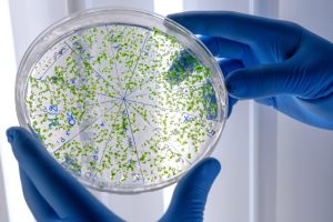 SZO: Hantavirus se možda proširio među putnicima na holandskom kruzeru