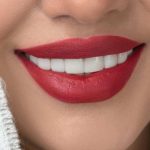 Savršen Hollywood smile po pristupačnim cenama u stomatološkoj ordinaciji Marco Dental Tourism