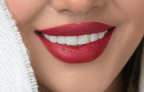 Savršen Hollywood smile po pristupačnim cenama u stomatološkoj ordinaciji Marco Dental Tourism