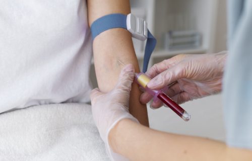 Japanski naučnici razvili veštačku ljubičastu krv: Odgovara svim krvnim grupama