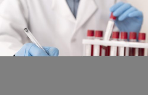 Veliki napredak: Test krvi koji detektuje prve signale 50 vrsta maligniteta