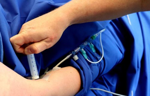 Svetski dan anestezije: Obeležavanje revolucije koja je zauvek promenila medicinu