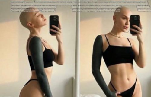 Skandal u modnoj industriji: "Devojka invalid" sa teškom pričom osramotila poznati brend (FOTO)