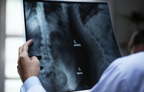 Retko stanje organizma: Organi smešteni kao u ogledalu, a normalno funkcionišu