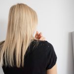 Većinu već imate kod kuće: Četiri prirodna sastojka koja pomažu u borbi protiv peruti