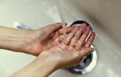 Zašto se prsti smežuraju u vodi: Nauka otkriva da je razlog potpuno drugačiji nego što smo mislili