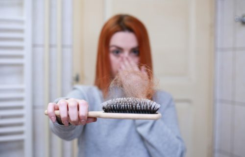 Kosa opada iz više razloga: Od stresa do nedostatka gvožđa, telo često šalje upozorenje
