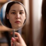 Dermatolozi otkrivaju trik za pronalaženje uzroka akni: Pogledajte gde se pojavljuju na licu