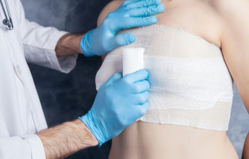 Spomenik koji menja pogled na rak: Bista žene sa jednom dojkom i ožiljkom od operacije (VIDEO)