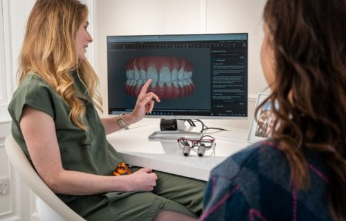 Prednosti All-on-4 implantata: Zašto sve više pacijenata bira ovu metodu?