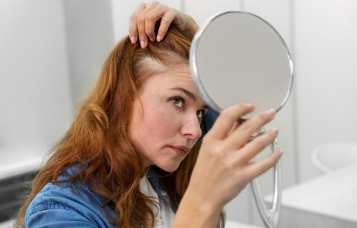 Vitamini za kosu nisu uvek bezazleni: Prevelika količina nekih nutrijenata može da pogorša opadanje