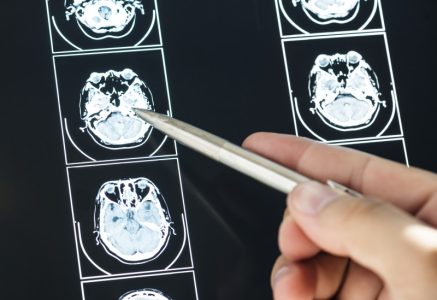 Um koji se ne gasi: Zašto je mozak iscrpljen i kada nije reč o “previše obaveza“
