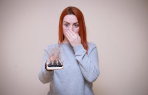 Kosa vam naglo opada? Uzrok može da bude mršavljenje od pre nekoliko meseci