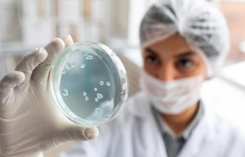 Salmonela može da se krije u svakodnevnim namirnicama: Prvi simptomi se javljaju i šest dana nakon zaraze