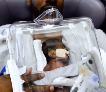 Prvi zagrljaj, posle dve nedelje: Otac iz Hjustona držao nedonoščad uz pomoć “skinkubatora“(VIDEO)