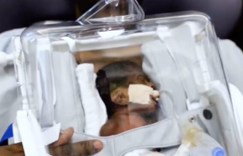 Prvi zagrljaj, posle dve nedelje: Otac iz Hjustona držao nedonoščad uz pomoć “skinkubatora“(VIDEO)
