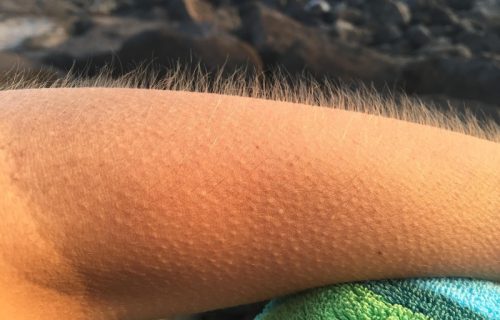 Zašto se ježimo kad čujemo dobru muziku? Iza ove reakcije krije se zanimljiv proces u mozgu